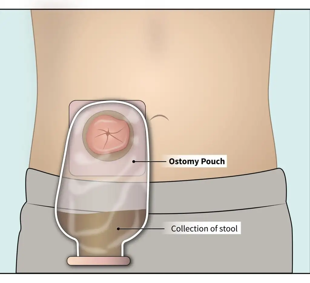 Serivce Image